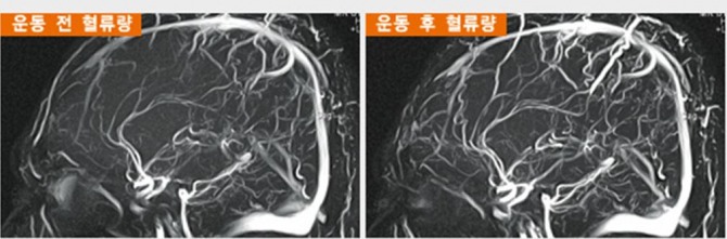 [김박사의 재미있는 브레인 톡톡(4)] 놀고먹는 뇌, 제 할 일 하는 뇌