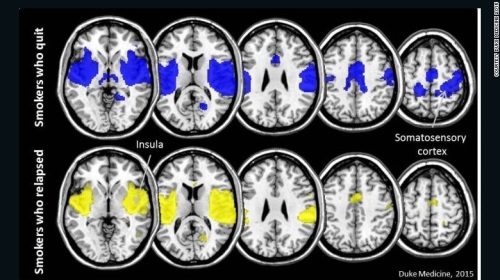 금연에 성공한 사람(위)과 실패한 사람(아래)의 뇌 MRI 촬영 사진. 금연에 성공한 사람들의 뇌에서는 보상을 관장하는 부위와 충동행동을 통제하는 부위의 상호작용이 강한 것으로 나타났다/사진= CNN 홈페이지