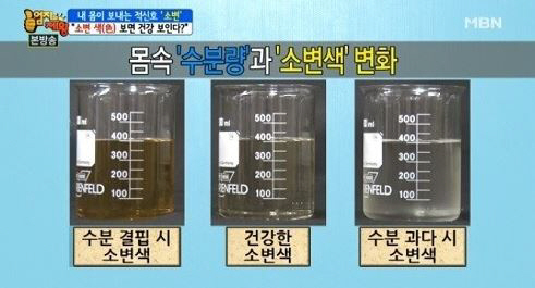 소변으로 보는 건강체크/ 사진=MBN '엄지의 제왕'