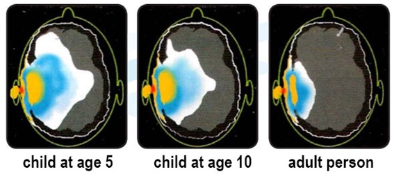 전자파로 인해 뇌에 받는 악영향은 나이가 어릴수록 심해진다.