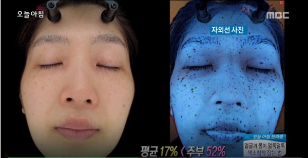 사진=MBC 방송캡처