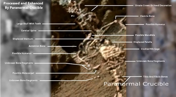 패러노블 크루서블은 화성에서 발견된 외계인 유골에서는 이처럼 머리위를 장식한 관을 비롯, 각각이 인간의 뼈와 매치된다고 분석하고 있다. 사진=패러노블 크루서블 