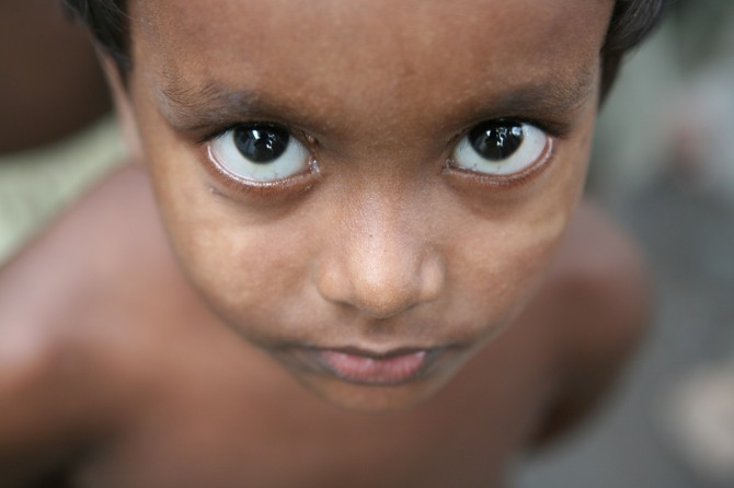 맑은 눈빛, 티타가르 한센인평화의 마을 아이