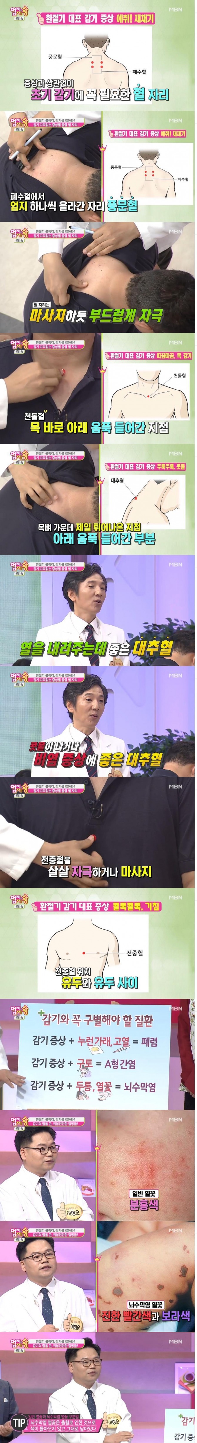 5일 밤 방송된 MBN '엄지의 제왕'에서는 감기와 비슷한 위험한 질병으로 폐렴, A형간염, 뇌수막염 구별법과 초기 감기를 예방하거나 증상을 완화시켜줄 수 있는 각종 혈자리를 찾는 방법이 소개됐다./사진=MBN방송 캡처