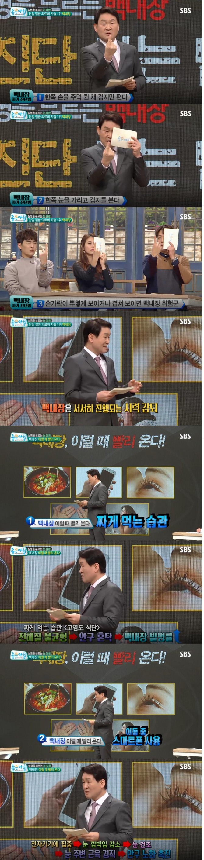 12일 방송된 SBS '좋은 아침' 건강백서에는 눈 건강 특집으로 실명을 부르는 눈질환! '백내장 자가진단법'이 소개됐다./사진=SBS 방송 캡처 