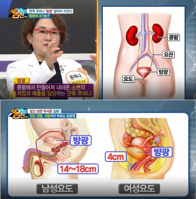 '나는 몸신이다' 여자 방광염 원인, 증상, 과민성방광염, 방광암, 신우신염 증상…밸런스 테이핑 요법 /사진=채널A '나는 몸신이다' 방송캡처 ('나는 몸신이다' -내 몸의 면역 주머니! 방광을 사수하라! 윤하나 비뇨기과 교수)