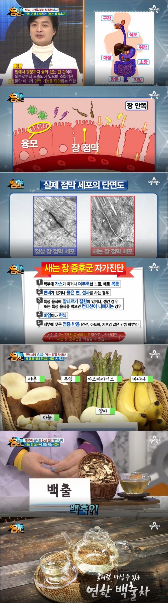 ['나는 몸신이다' 새는 장 증후군 원인, 자가진단법, 한방치료…장에 좋은 음식! 강승완 통합의학교수, 장동민한의사 출연 (112회)] /사진=채널A '나는 몸신이다' 112회 방송캡처 ('나는 몸신이다' '면역 최전선, 장(腸)이 샌다! - 새는 장 증후군' 편)