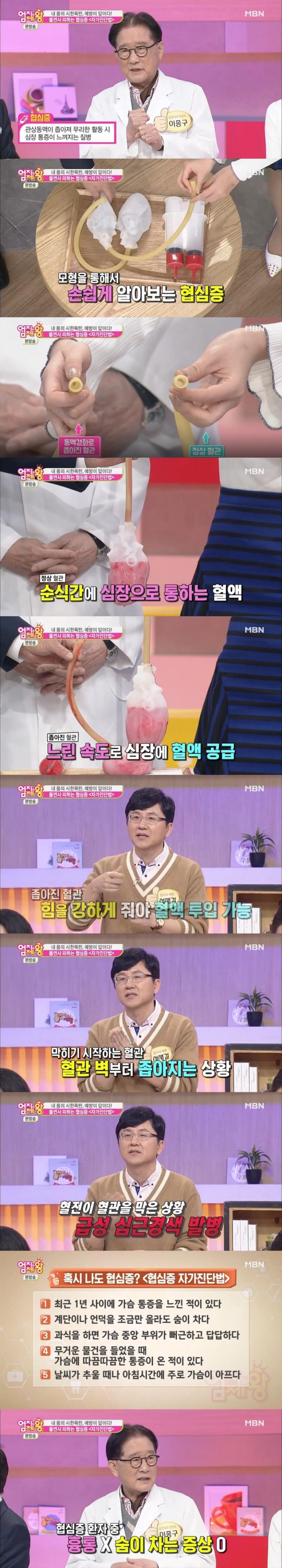 지난 14일 방송된 MBN '엄지의 제왕'에서는 '심혈관 질환' 특집으로 협심증 자가진단법이 소개됐다./사진=MBN방송 캡처