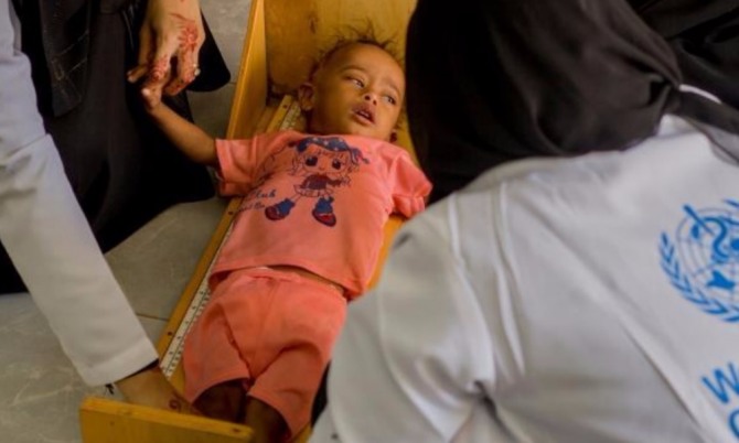 예멘에서 올해 4월부터 다시 확대되기 시작한 콜레라 감염자가 60만명을 넘어선 것으로 나타났다. 자료=WHO