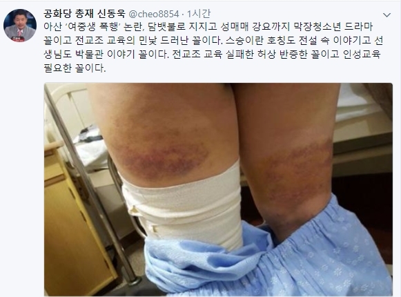 부산과 강릉에서 여중생 폭행사건이 일어난 사실이 잇따라 전해진데 이어 충남 아산에서도 여중생 폭행 사건이 일어나 충격이 더해지고 있는 가운데 피해자 아버지의 말에 이목이 집중되고 있다. 사진=신동욱 트위터
