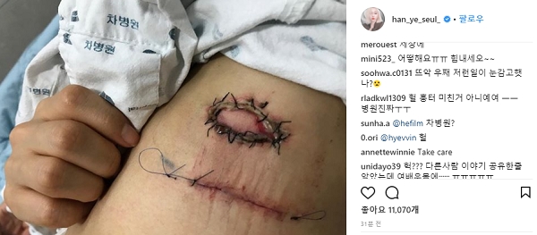 배우 한예슬이 지방종 제거 수술을 받다 의료사고를 당했다고 주장하고 있다. 사진=인스타그램. 