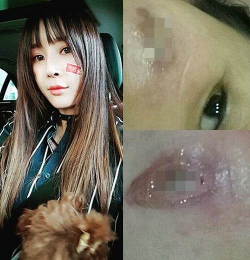 가수 미나의 동생 니키타가 2년 전 병원에서 의료사고를 당했다고 주장했다. 사진=니키타 인스타그램