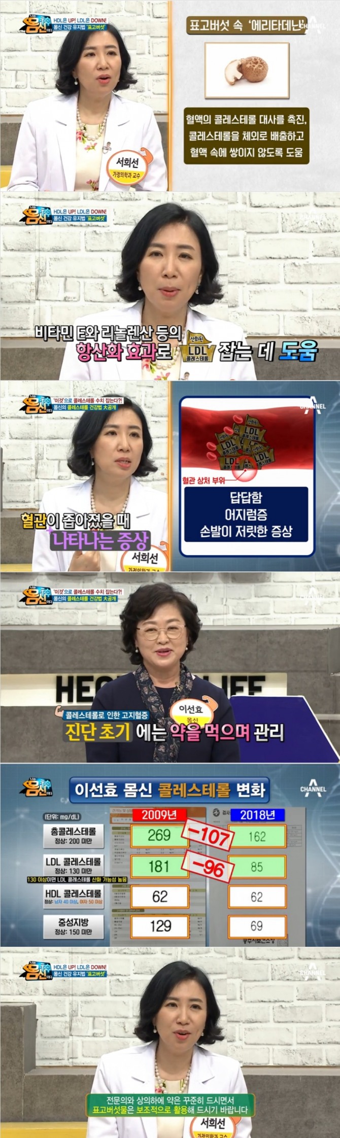 지난 1일 방송된 채널A '나는 몸신이다' 174회에서는 '콜레스테롤 수치의 함정' 특집편이 방송된 가운데 표고버섯으로 콜레스테롤 수치를 낮춘 사례자가 출연해 시선을 사로잡았다. 사진=채널A 방송 캡처