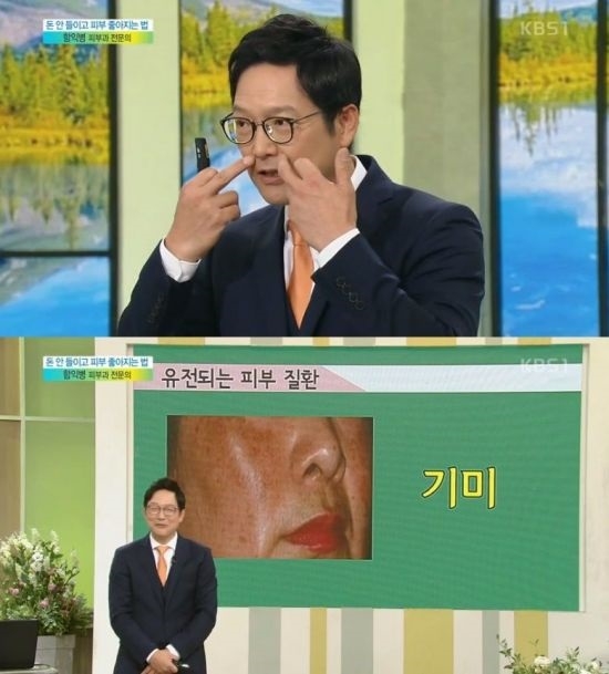 '아침마당'에 출연한 피부과전문의 함익병이 '미백연고'로 기미를 옅어지게 할 수 있다고 설명했다. 사진=KBS1