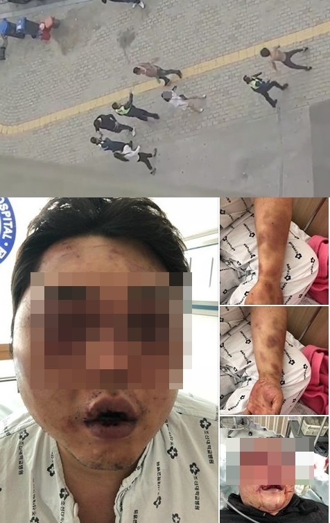 광주 광산구에서 심각한 수준의 폭행 사건이 발생, 가해자들을 엄벌에 처해달라는 국민 청원이 빗발치고 있다. 사진=페이스북