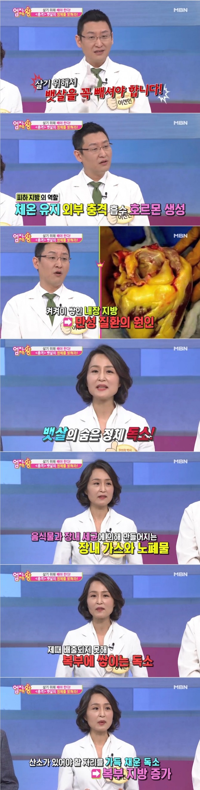 29일 밤 방송된 MBN '엄지의 제왕' 281회에서는 '살기 위해 빼야 한다! 2주 완성 뱃살 퇴치'를 주제로 이선민 가정의학과 전문의, 정세연 한의사가 출연했다. 사진=MBN 방송 캡처