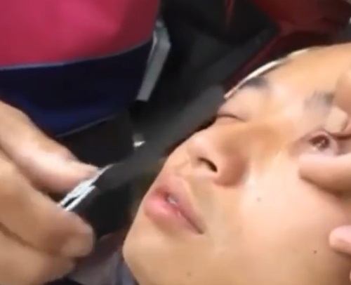 중국에서 행해진다는 '안구 면도'가 온라인에서 화제다. 사진=유튜브