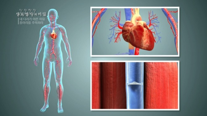 생로병사의 비밀 다혈관의 무서움! 끝날때까지 끝난게 아니다 7
