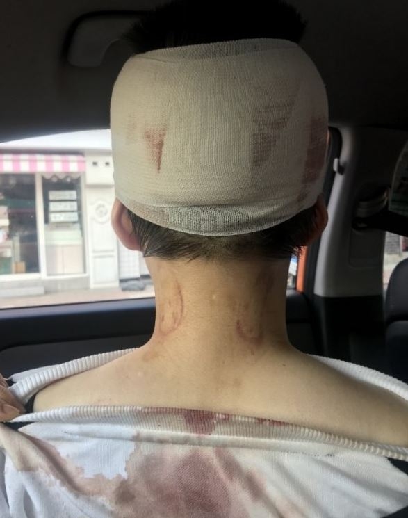 폭행 당한 여성의 뒷모습(출처=온라인 커뮤니티 갈무리)