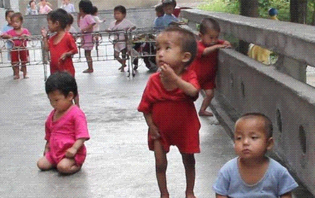 식량난으로 영양실조에 시달리고 있는 북한의 어린이들.