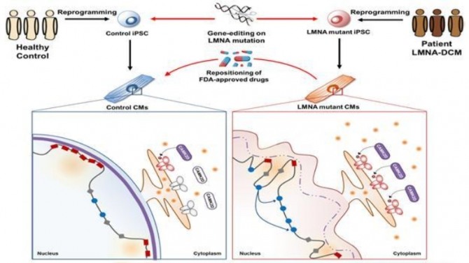 일반인으로부터 생성된 역분화줄기세포 유래 심근세포(control CMs)는 정상적인 핵막 구조를 가지고 있으며 유전자의 발현이 정교하게 조절된다. 유전자의 발현이 억제되어 있는 부분은 핵막의 lamin A/C(LMNA)에 주로 결합되어 있다(왼쪽, 빨간색 네모=발현이 억제되어 있는 유전자). 하지만 환자로부터 생성된 역분화줄기세포 유래 심근세포(mutant CMs)는 비정상적인 핵막의 형태를 띄고 있으며 일부 유전자들이 발현이 증가하고 (오른쪽, 파란색 동그라미=비정상적인 발현이 시작되는 유전자) 이에 따라서 기존에 억제되어 있던 신호전달 체계가 활성화되어 질환이 유발됨을 확인했다. 그림=성균관대