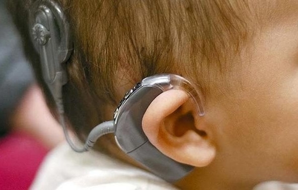 달팽이관 임플랜트를 통해 상실된 청력을 90~100%까지 회복시켜주는 기술이 영국 그리니치대에서 개발됐다.상용화까지는 아직 시간이 걸린다. (사진=Center for Hearing.org)