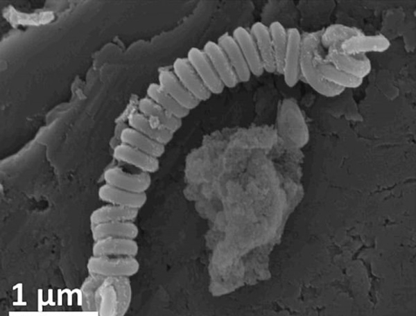 강과 바다의 미생물에 해를 끼치지 않고 미세플라스틱을 해결하는 방법이 제시됐다. 호주 애들레이드 대 연구팀은 나노 탄소 코일형 자석을 사용하는 독특한 방법을 내놓았다. (사진=매터)