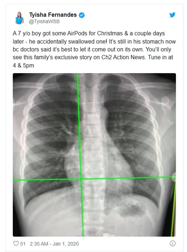 미국 조지아주의 7세 소년이 크리스마스선물로 받은 애플 무선이어폰 에어팟을 삼켜 병원으로 실려갔다. 사진=티샤 페르난데스 트위터