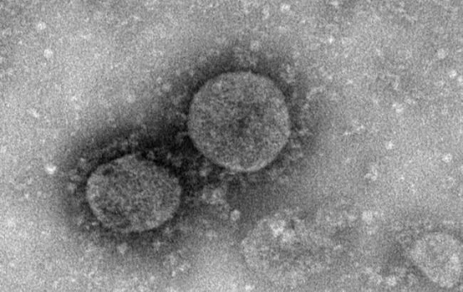 중국 질병대책센터가 공개한 신형 코로나 바이러스 전자현미경 사진.
