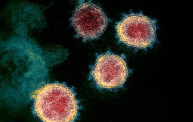 사진은 미국연구팀이 공개한 신종 코로나바이러스(코로나19) 전자현미경 촬영사진.