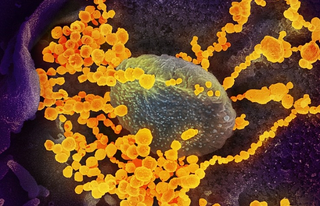 사진은 신종 코로나바이러스(코로나19) 전자현미경 영상=미국 국립 알레르기‧감염병연구소 제공.