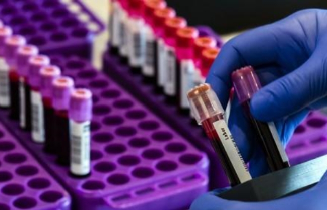 미국 질병통제예방센터(CDC)가 코로나19 무증상 환자 규모를 파악하기 위해 항체검사를 시작했다고 5일(현지시간) 미국 매체들이 전했다. 