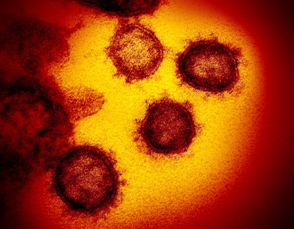 신종 코로나바이러스 전자현미경 사진
