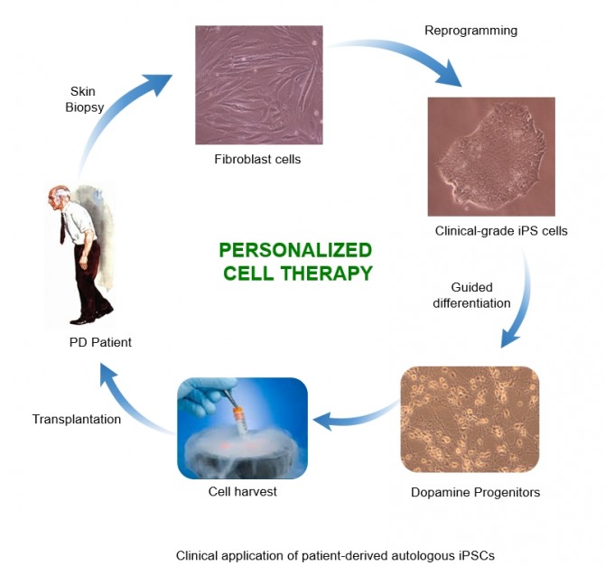 맞춤형 줄기세포를 이용한 파킨슨병 치료법 모식도. 사진=KAIST