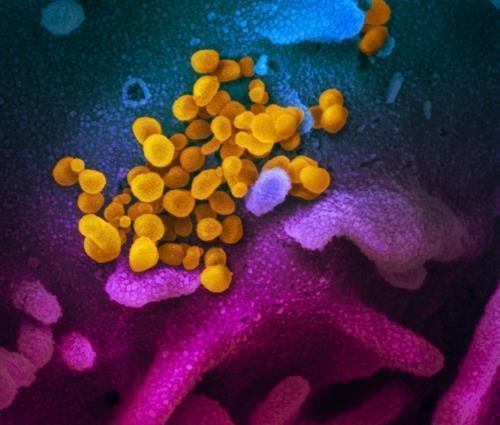 신종 코로나바이러스(노란색)가 세포 표면(청색·분홍색)에 몰려 있다.미국 확진자의 검체를 배양해 전자현미경으로 관찰한 것이다.사진=미 NIH 국립 알레르기 감염병 연구소 제공
