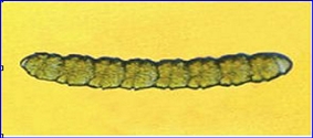 적조생물 Cochlodinium Polykrikoides. 사진=해양수산부
