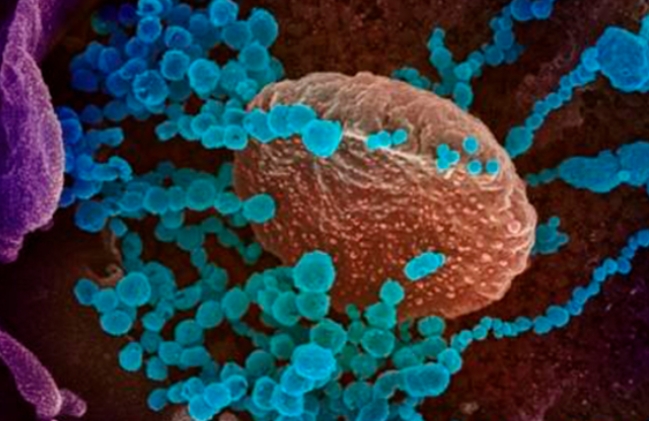 코로나19에 감염된 숙주세포에서 자라나는 촉수의 전자현미경 사진.