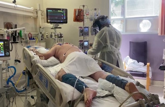 사진은 미국 플로리다주 한 병원 중환자실에서 의료진이 코로나19 감염자를 돌보고 있는 모습.