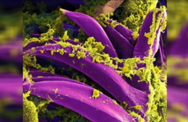 사진은 선페스트 바이러스의 전자현미경 이미지.