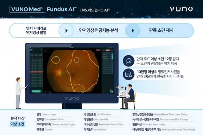 식품의약품안전처는 현재까지 총 4개 제품을 '혁신의료기기'로 지정했다. 사진은 ㈜뷰노의 의료영상진단 보조소프트웨어 '뷰노메드 펀더스 AI'의 작동방식. 사진=㈜뷰노