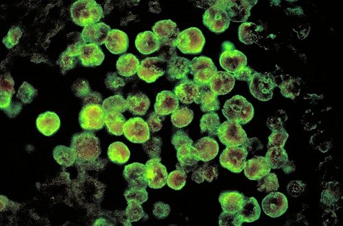 뇌 먹는 아메바인 '네글레리아 파울러리' 아메바의 현미경 사진. 위키피디아