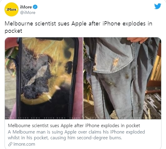 애플 아이폰X가 폭발해 화상을 입은 호주의 한 피해자가 애플을 고소했다. 사진은 트위터에 올라온 폭발로 불에 탄 바지 모습. 사진=PC월드