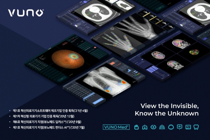 뷰노가 국내 1호 혁신의료기기소프트웨어 제조기업 인증을 획득했다. 사진=뷰노