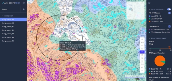 '루닛 스코프 PD-L1'이 조직 슬라이드를 분석한 모습. 사진=루닛