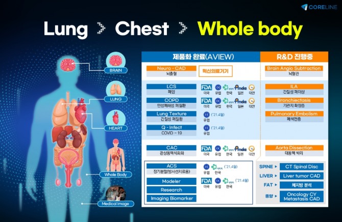 코어라인소프트의 AI 진단 솔루션. 사진=코어라인소프트