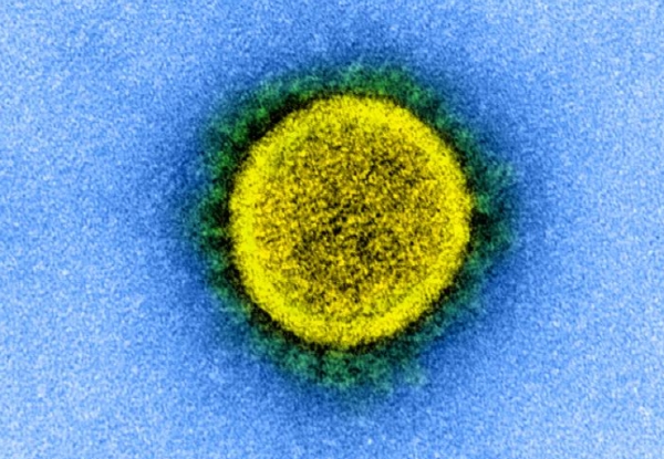 전자현미경으로 관찰된 코로나19 바이러스 모습. 사진=로이터