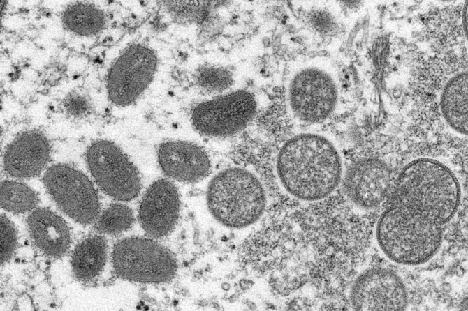 미국 질병통제예방센터가 공개한 원숭이두창 바이러스. 사진=뉴시스