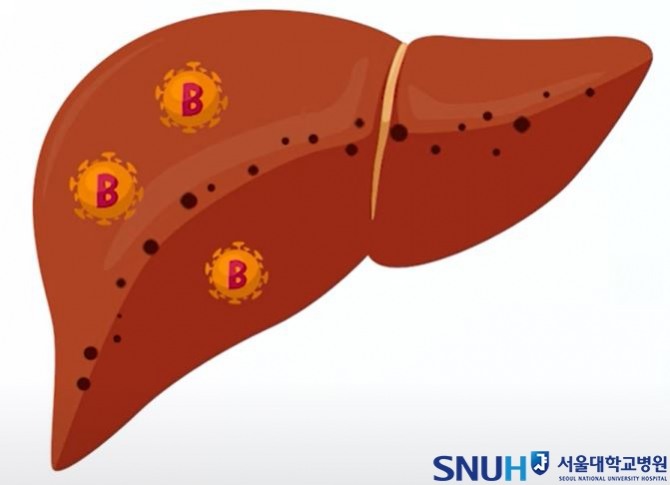 B형간염 바이러스. 이미지=서울대병원