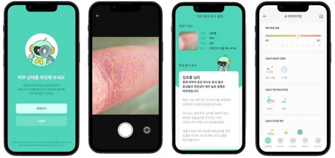 아토맘, ‘AI 피부건강측정서비스’ 앱 서비스 화면. 사진=아토맘코리아