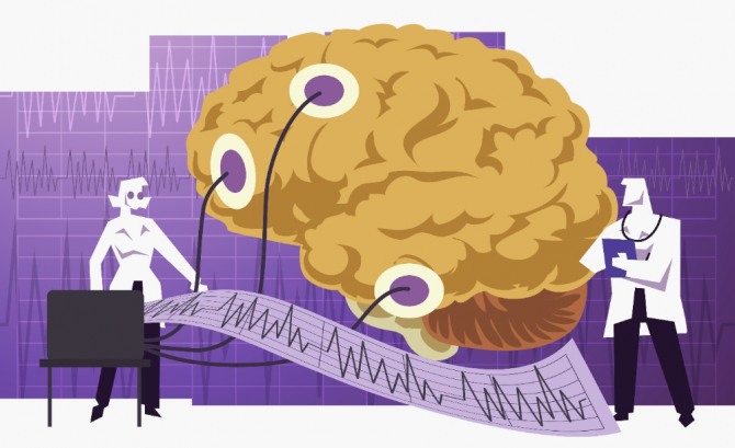 흔히 '간질'로 알려진 뇌전증은 뇌의 문제로 발생한 질환이지만 성격의 결함이나 극단적인 행동의 결과를 낳을 수 있다. 자료=글로벌이코노믹